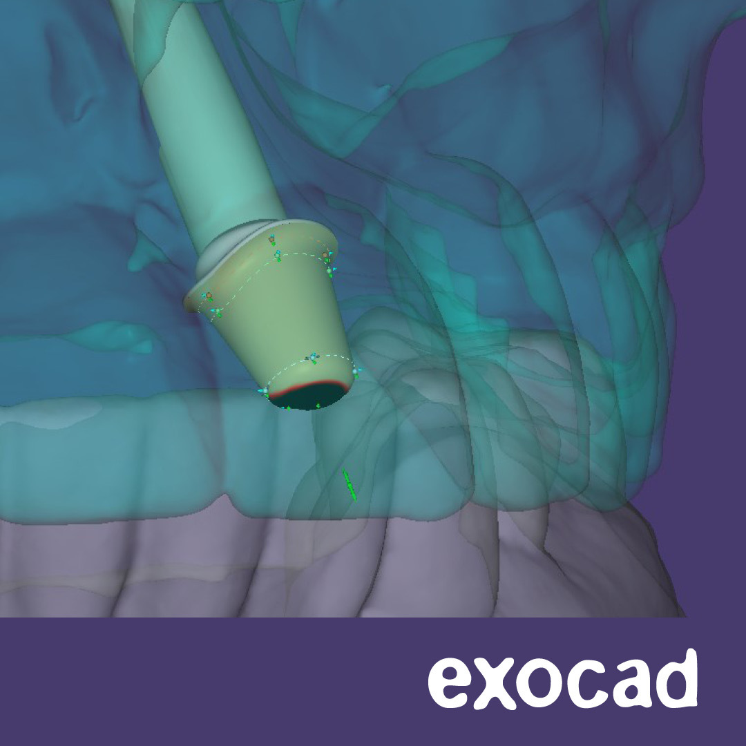 exocad_3dmodel_1080x1080